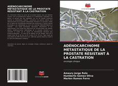 ADÉNOCARCINOME MÉTASTATIQUE DE LA PROSTATE RÉSISTANT À LA CASTRATION的封面