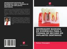 Couverture de ABORDAGEM BASEADA EM EVIDÊNCIAS PARA A TOMADA DE DECISÃO EM IMPLANTES DENTÁRIOS