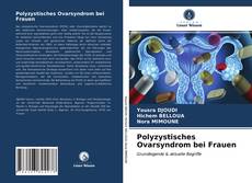 Portada del libro de Polyzystisches Ovarsyndrom bei Frauen