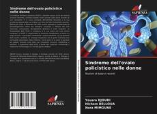 Portada del libro de Sindrome dell'ovaio policistico nelle donne