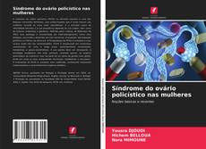 Couverture de Síndrome do ovário policístico nas mulheres