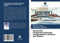 Portada del libro de Gemischte röntgendurchlässige röntgendichte Läsionen des Kiefers