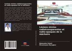 Обложка Lésions mixtes radiotransparentes et radio-opaques de la mâchoire