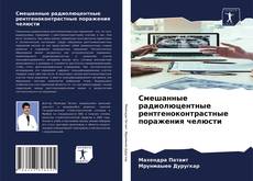 Обложка Смешанные радиолюцентные рентгеноконтрастные поражения челюсти