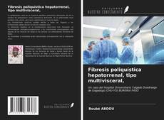 Bookcover of Fibrosis poliquística hepatorrenal, tipo multivisceral,