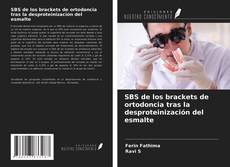 Bookcover of SBS de los brackets de ortodoncia tras la desproteinización del esmalte