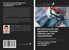 Couverture de Reconstrucción del ligamento cruzado anterior por los isquiotibiales