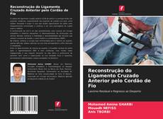 Couverture de Reconstrução do Ligamento Cruzado Anterior pelo Cordão de Fio