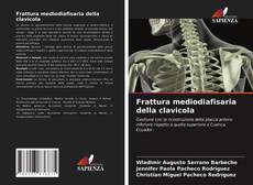 Frattura mediodiafisaria della clavicola kitap kapağı