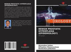 BENIGN PROSTATIC HYPERPLASIA (EPIDEMIOLOGY)的封面