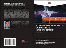 HYPERPLASIE BÉNIGNE DE LA PROSTATE (ÉPIDÉMIOLOGIE) kitap kapağı