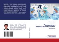 Copertina di Рецидивный эхинококкоз печени