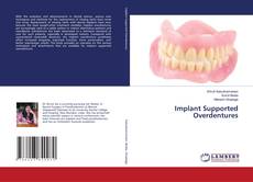 Copertina di Implant Supported Overdentures