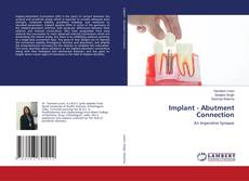 Implant - Abutment Connection的封面