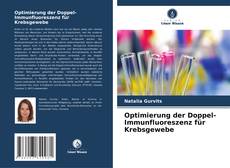 Couverture de Optimierung der Doppel-Immunfluoreszenz für Krebsgewebe