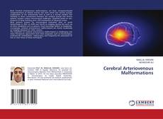 Copertina di Cerebral Arteriovenous Malformations