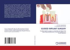 Copertina di GUIDED IMPLANT SURGERY