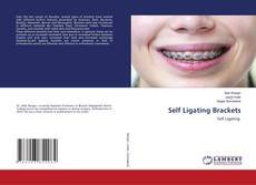 Copertina di Self Ligating Brackets