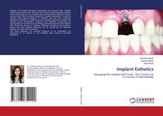 Bookcover of Implant Esthetics