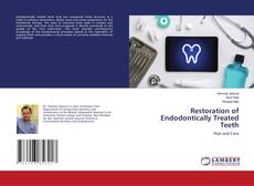 Copertina di Restoration of Endodontically Treated Teeth
