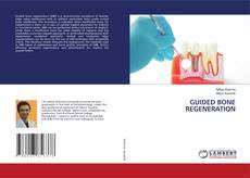 Copertina di GUIDED BONE REGENERATION