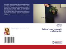 Copertina di Role of third molars in malocclusion