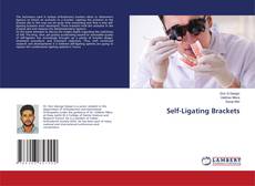 Copertina di Self-Ligating Brackets