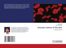 Copertina di Vascular Lesions of the Skin