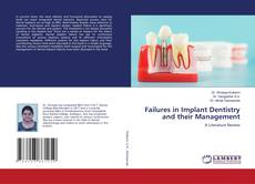 Copertina di Failures in Implant Dentistry and their Management