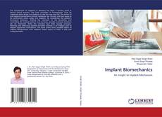 Bookcover of Implant Biomechanics