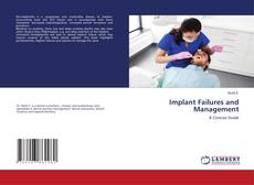 Copertina di Implant Failures and Management