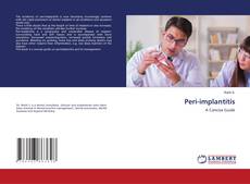 Copertina di Peri-implantitis