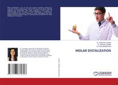 Copertina di MOLAR DISTALIZATION