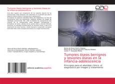 Couverture de Tumores óseos benignos y lesiones óseas en la infancia-adolescencia