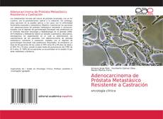 Portada del libro de Adenocarcinoma de Próstata Metastásico Resistente a Castración
