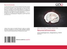 Bookcover of Neurocisticercosis
