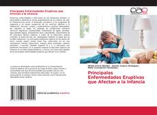 Buchcover von Principales Enfermedades Eruptivas que Afectan a la Infancia