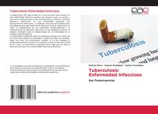 Couverture de Tuberculosis: Enfermedad Infecciosa