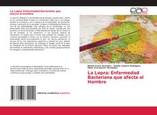 Bookcover of La Lepra: Enfermedad Bacteriana que afecta al Hombre