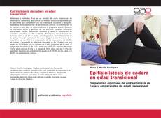 Bookcover of Epifisiolistesis de cadera en edad transicional