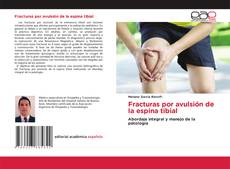 Fracturas por avulsión de la espina tibial的封面
