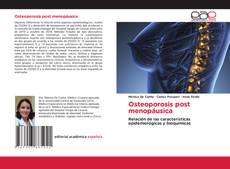 Bookcover of Osteoporosis post menopáusica