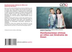 Manifestaciones clinicas en niños con Sindrome de Down的封面