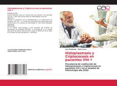 Bookcover of Histoplasmosis y Criptococosis en pacientes VIH +