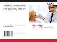Bookcover of Implantología
