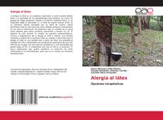 Bookcover of Alergia al látex