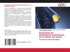 Bookcover of Asociación de marcadores moleculares en el cáncer de mama