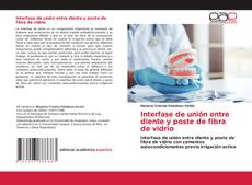 Bookcover of Interfase de unión entre diente y poste de fibra de vidrio