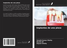 Buchcover von Implantes de una pieza