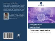 Copertina di Exantheme bei Kindern